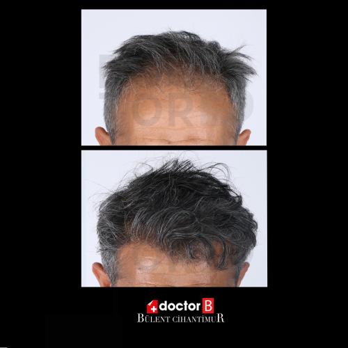fotos antes y después de nuestros pacientes 0